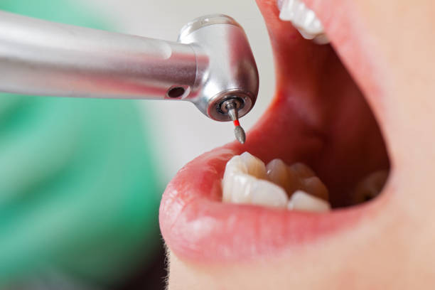 Best Broken or Chipped Tooth Repair in Taneytown, MD